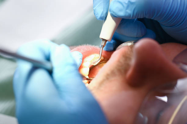 Best Cosmetic Emergency Dentistry in Opelousas, LA