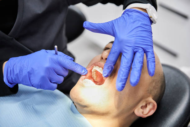 Best Urgent Care for Lost Fillings or Crowns in Opelousas, LA