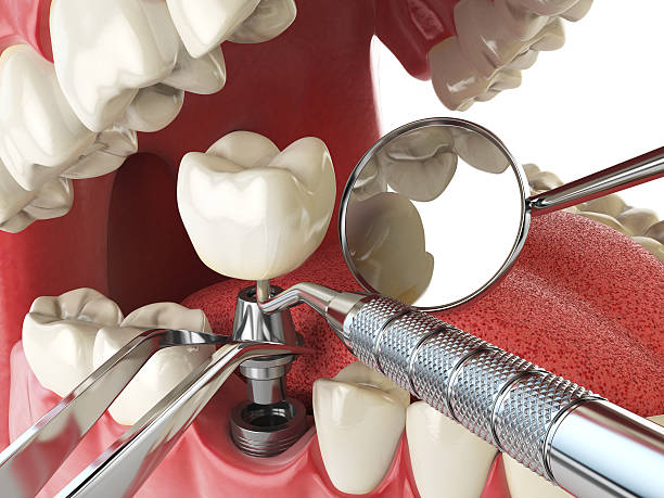 Best Emergency Gum Treatment in Opelousas, LA